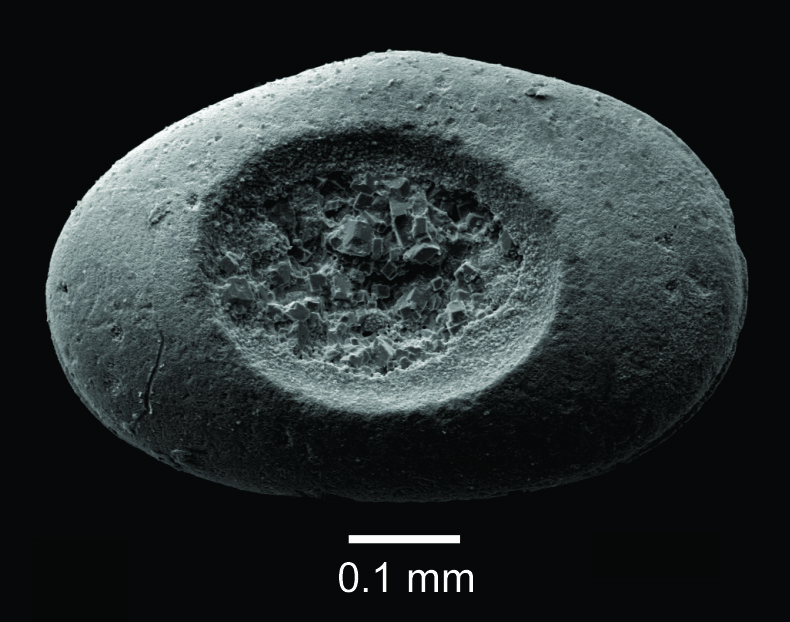 A shell of an ostracod called Cytherella piacabucuensis showing a drill hole made by a predatory gastropod. Source: Villegas-Martín et al. (2023)